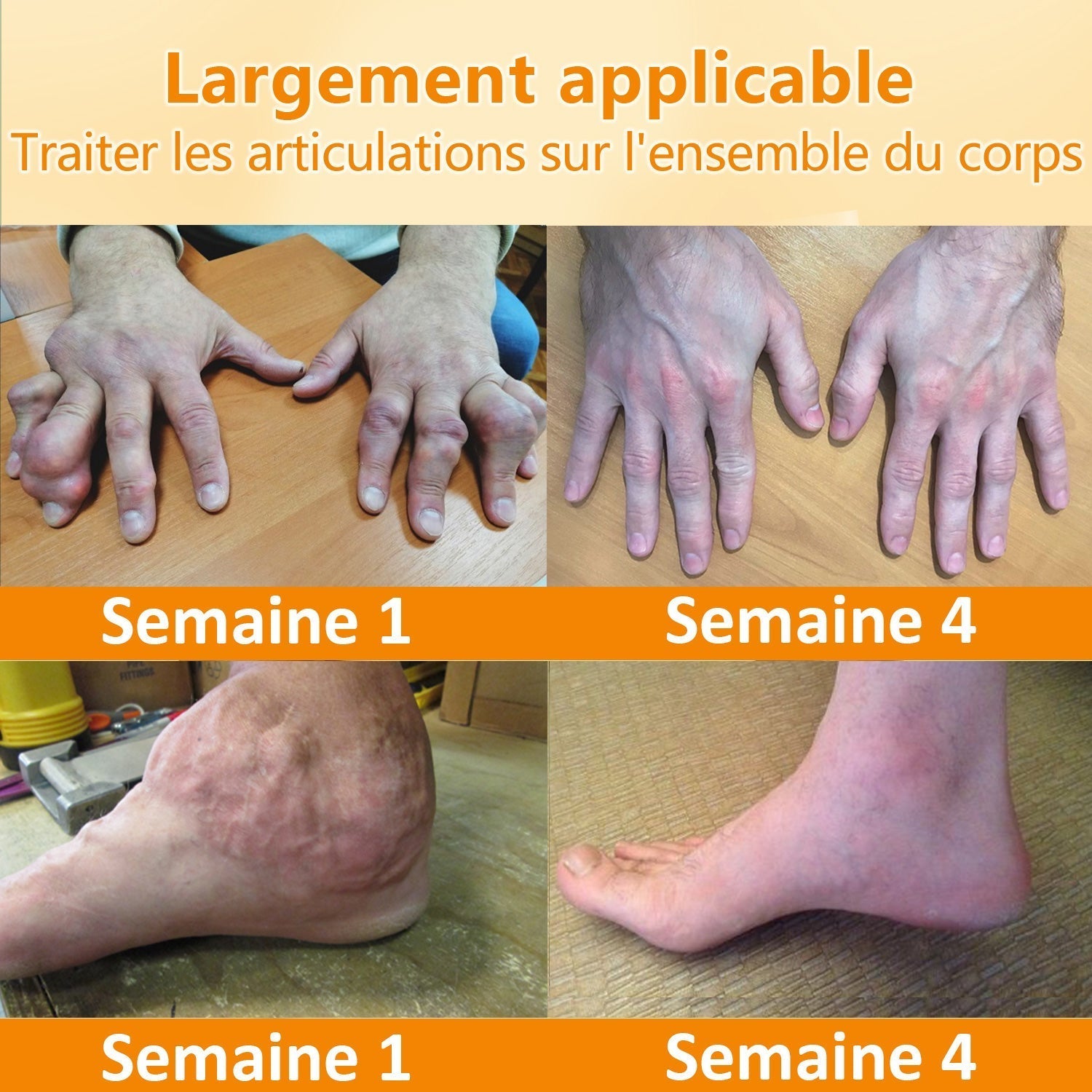 Crème Apaisante au Venin d'Abeille